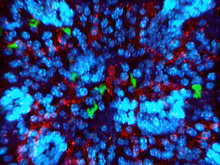 Preparation of Murine Submandibular Salivary Gland for Upright Intravital Microscopy