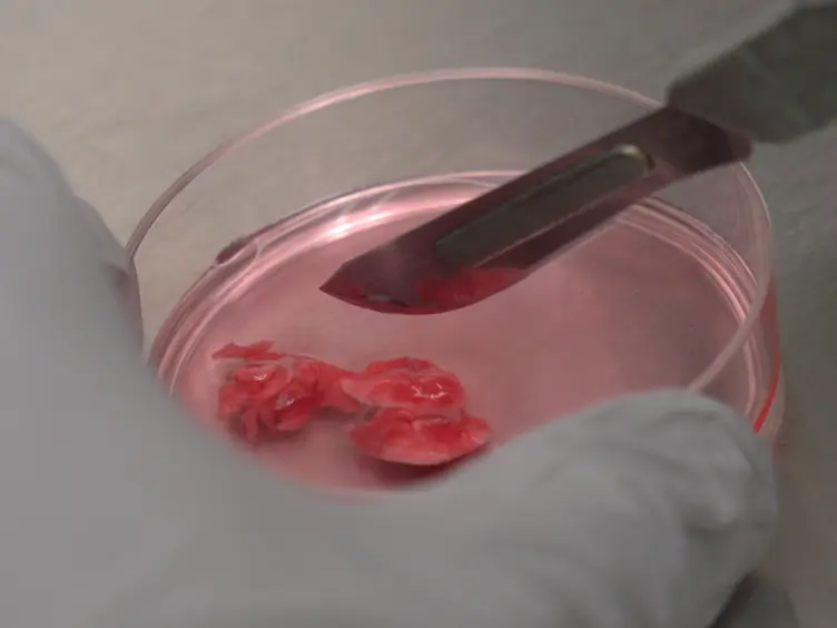 Isolation and <em>In Vitro</em> Culture of Murine and Human Alveolar Macrophages