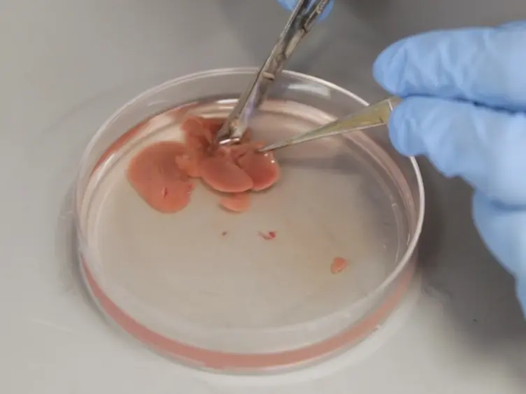 Partial Lobular Hepatectomy: A Surgical Model for Morphologic Liver Regeneration