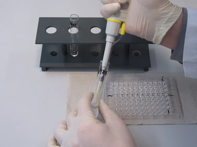 Titration ELISA as a Method to Determine the Dissociation Constant of Receptor Ligand Interaction