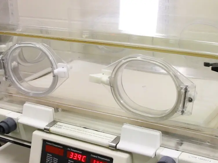 Deep Vein Thrombosis Induced by Stasis in Mice Monitored by High Frequency Ultrasonography