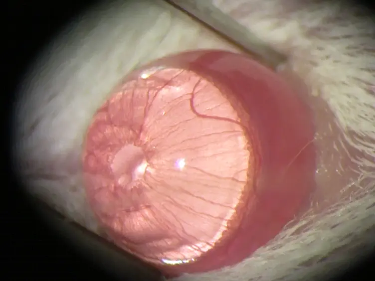 Puncture-Induced Iris Neovascularization as a Mouse Model of Rubeosis Iridis
