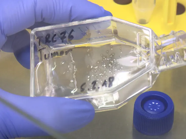Isolation of Human Endothelial Cells from Normal Colon and Colorectal Carcinoma - An Improved Protocol
