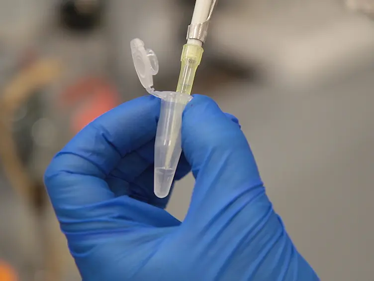 A Simple, Rapid, and Quantitative Assay to Measure Repair of DNA-protein Crosslinks on Plasmids Transfected into Mammalian Cells