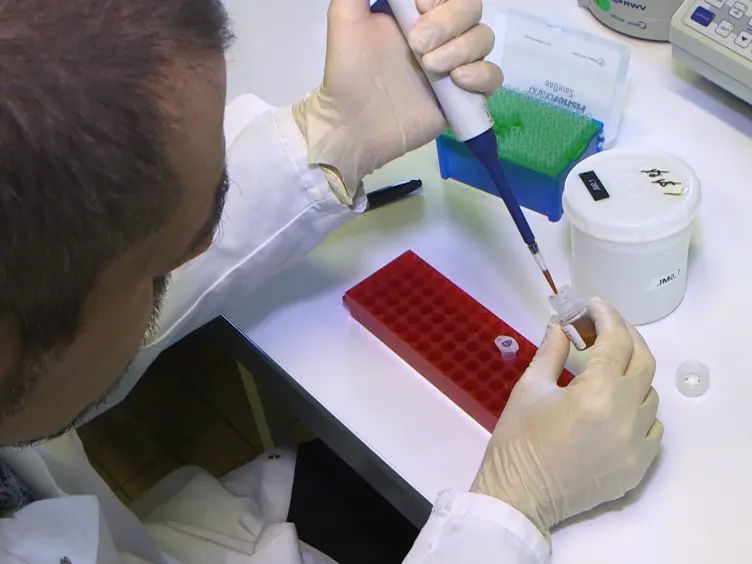 Development and Validation of an Ultrasensitive Single Molecule Array Digital Enzyme-linked Immunosorbent Assay for Human Interferon-α