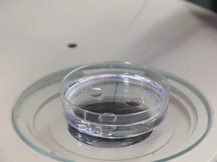 Using Mouse Oocytes to Assess Human Gene Function During Meiosis I