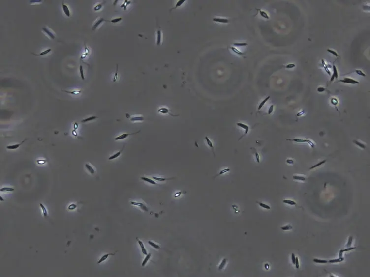 Polysome Profiling in <em>Leishmania</em>, Human Cells and Mouse Testis