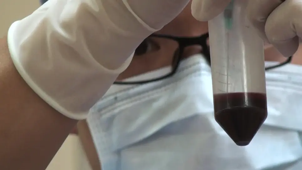 Preparation, Procedures and Evaluation of Platelet-Rich Plasma Injection in the Treatment of Knee Osteoarthritis