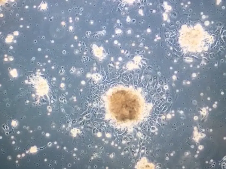 A Simplified and Efficient Method to Isolate Primary Human Keratinocytes from Adult Skin Tissue