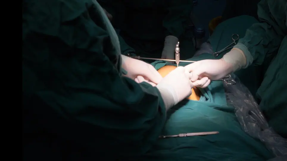 Introduction of Intracapsular Rotary-cut Procedures (IRCP): A Modified Hysteromyomectomy Procedures Facilitating Fertility Preservation