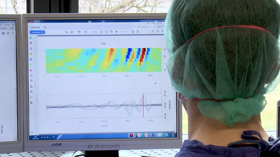 Data Acquisition and Analysis In Brainstem Evoked Response Audiometry In Mice