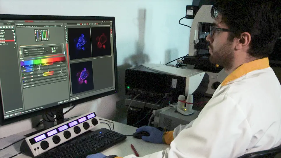 Growth and Characterization of Irradiated Organoids from Mammary Glands