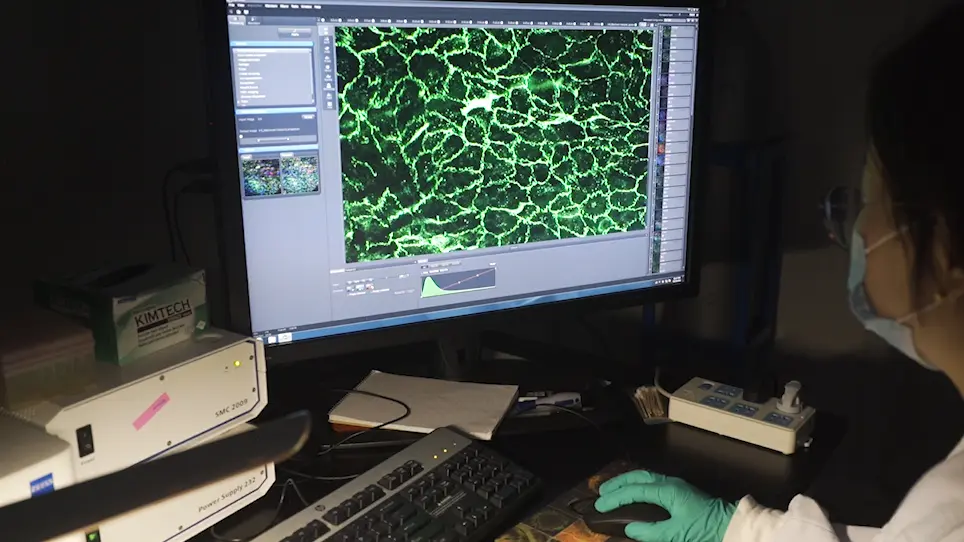 Using En Face Immunofluorescence Staining to Observe Vascular Endothelial Cells Directly