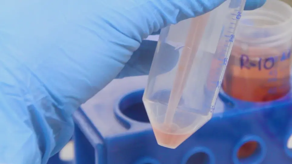 Processing of Bronchoalveolar Lavage Fluid and Matched Blood for Alveolar Macrophage and CD4<sup>+</sup> T-cell Immunophenotyping and HIV Reservoir Assessment