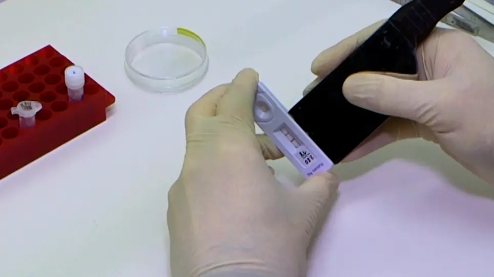 Field Postmortem Rabies Rapid Immunochromatographic Diagnostic Test for Resource-Limited Settings with Further Molecular Applications