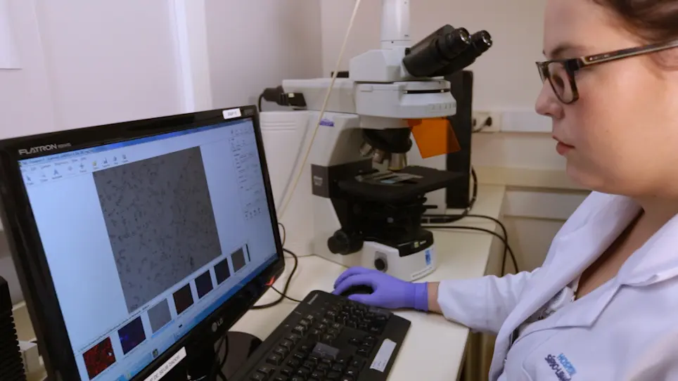 Quantification of Tumor Cell Adhesion in Lymph Node Cryosections