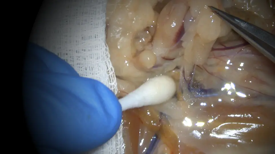 Dissection of Pelvic Autonomic Ganglia and Associated Nerves in Male and Female Rats