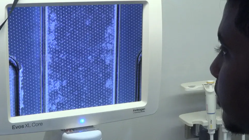 Generation of a Human iPSC-Based Blood-Brain Barrier Chip