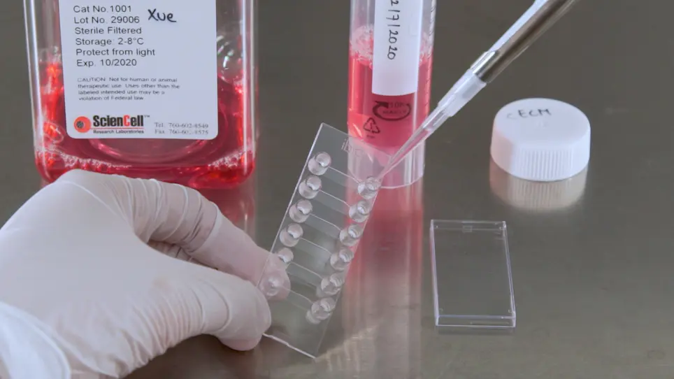 In Vitro Microfluidic Disease Model to Study Whole Blood-Endothelial Interactions and Blood Clot Dynamics in Real-Time
