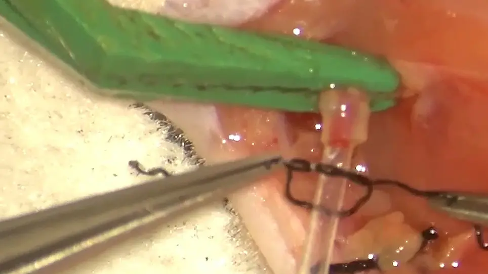 Optimization of the Cuff Technique for Murine Heart Transplantation