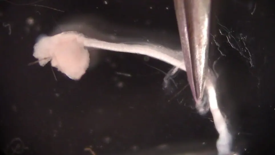 Imaging and Analysis of Neurofilament Transport in Excised Mouse Tibial Nerve