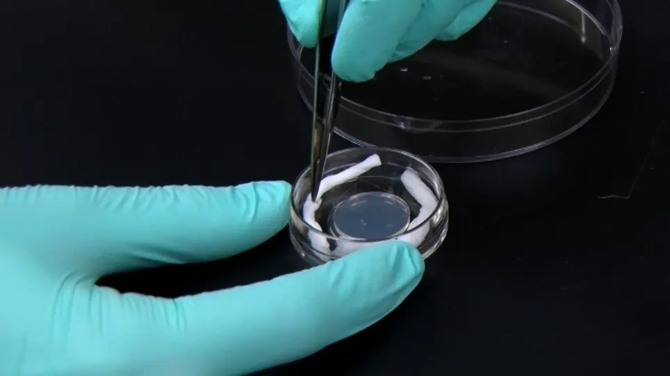 Kinetic Visualization of Single-Cell Interspecies Bacterial Interactions