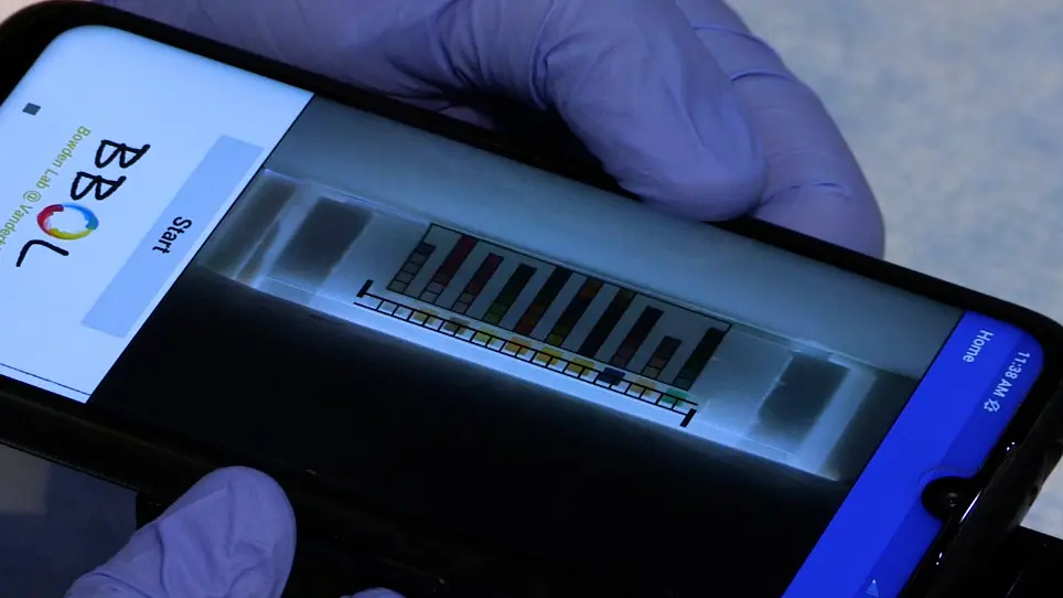 Low-Cost, Volume-Controlled Dipstick Urinalysis for Home-Testing