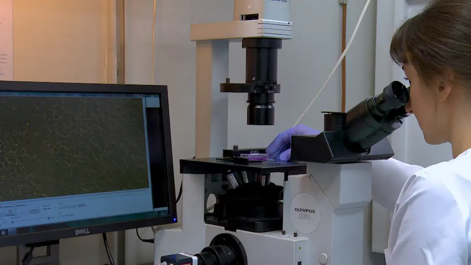 Quantification of Cell-Substrate Adhesion Area and Cell Shape Distributions in MCF7 Cell Monolayers