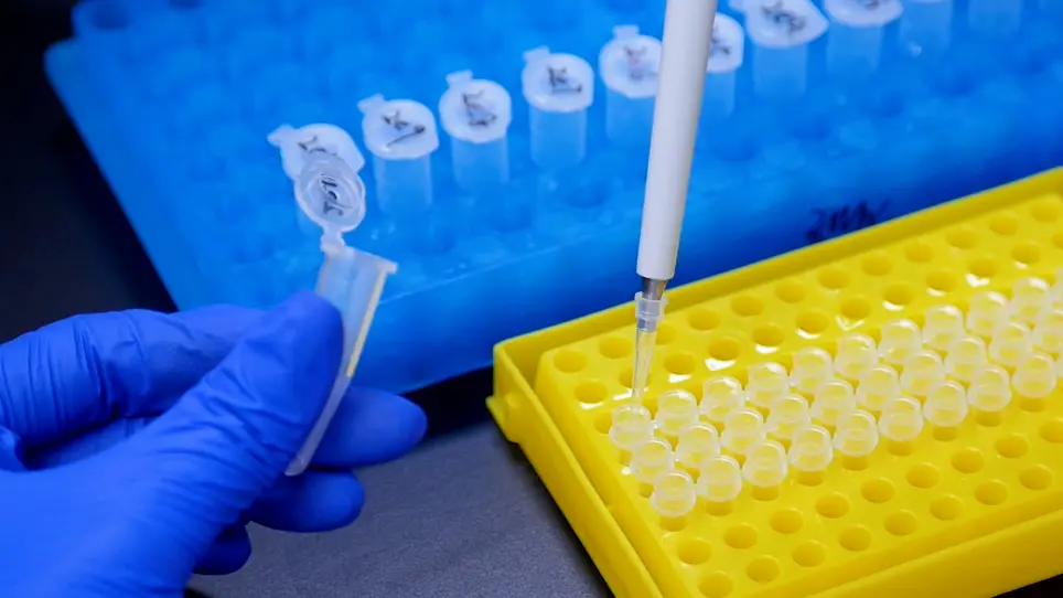 Quantification of Circulating Pig-Specific DNA in the Blood of a Xenotransplantation Model