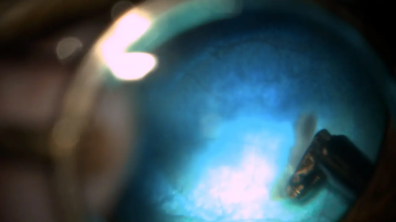 Subretinal Transplantation of Human Embryonic Stem Cell-Derived Retinal Tissue in a Feline Large Animal Model