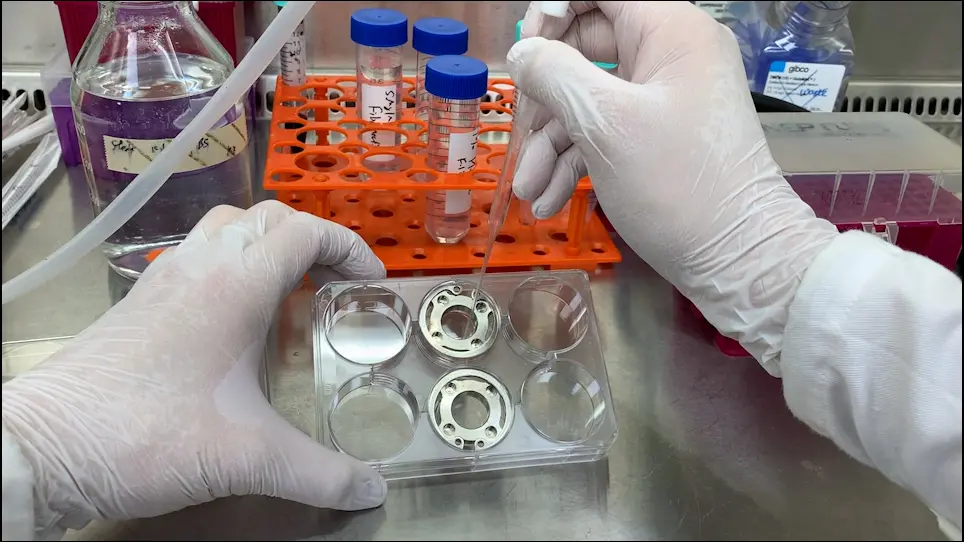 Segmenting Growth of Endothelial Cells in 6-Well Plates on an Orbital Shaker for Mechanobiological Studies