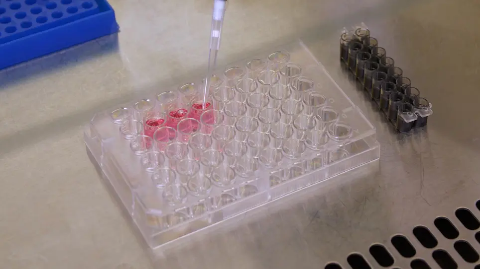 Genome Engineering of Primary Human B Cells Using CRISPR/Cas9