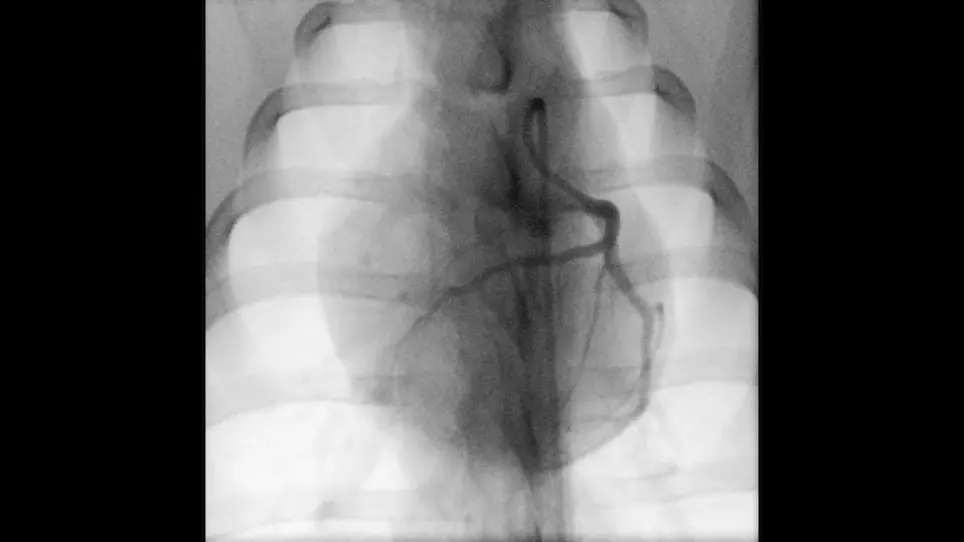 Post-Myocardial Infarction Heart Failure in Closed-chest Coronary Occlusion/Reperfusion Model in Göttingen Minipigs and Landrace Pigs