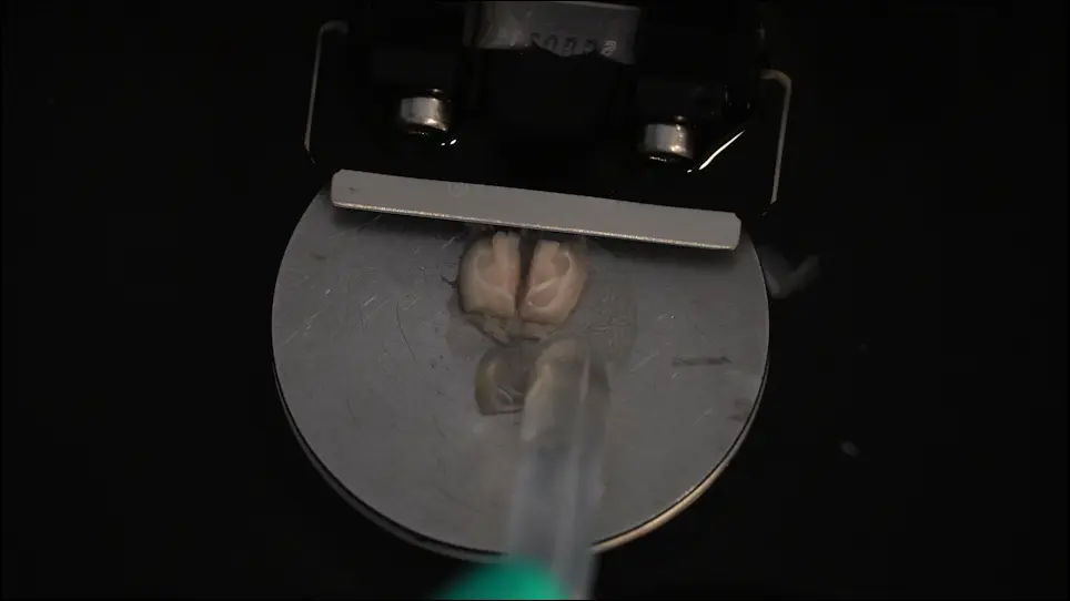 Preparation of Acute Slices from Dorsal Hippocampus for Whole-Cell Recording and Neuronal Reconstruction in the Dentate Gyrus of Adult Mice