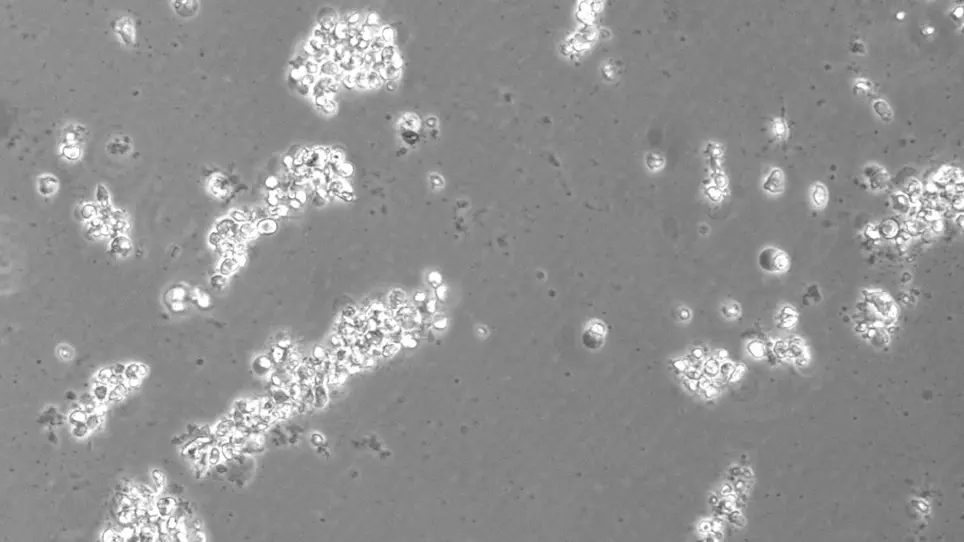 Direct Reprogramming of Human Fibroblasts into Myoblasts to Investigate Therapies for Neuromuscular Disorders