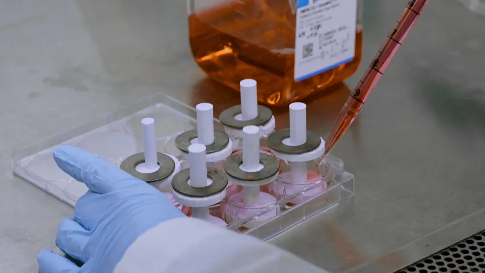 Modeling Breast Cancer in Human Breast Tissue using a Microphysiological System