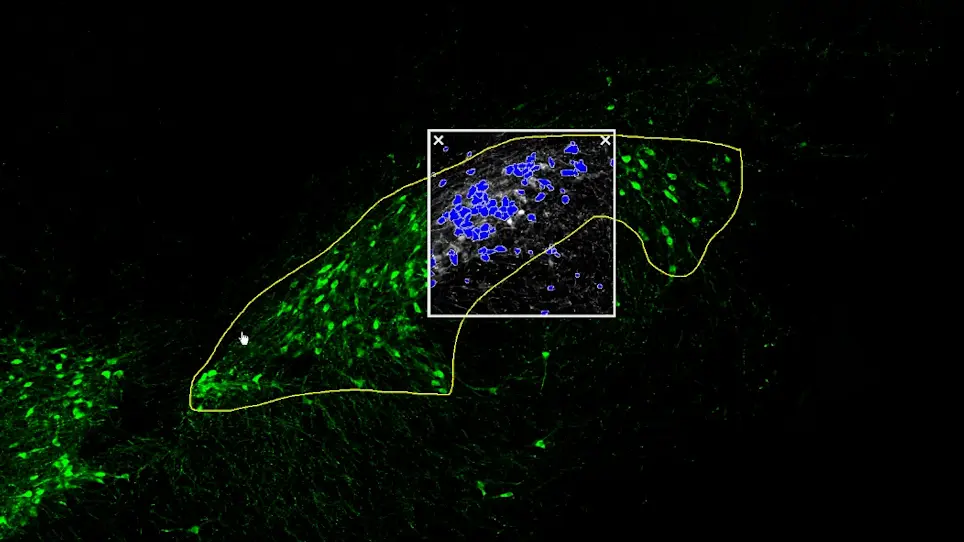 Semi-Quantitative Determination of Dopaminergic Neuron Density in the Substantia Nigra of Rodent Models using Automated Image Analysis