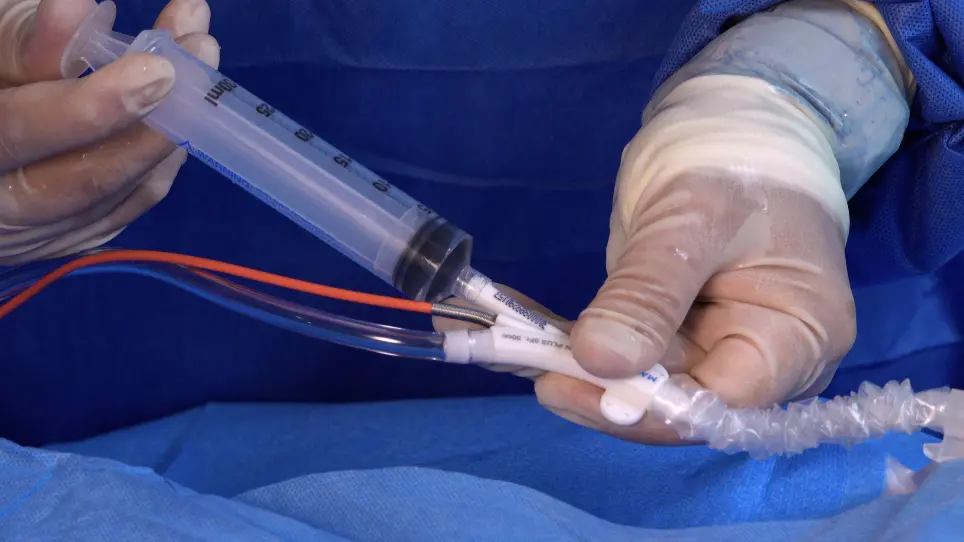 The Intra-Aortic Balloon Pump