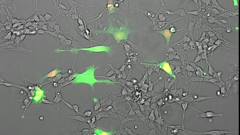 Co-culture of Glioblastoma Stem-like Cells on Patterned Neurons to Study Migration and Cellular Interactions