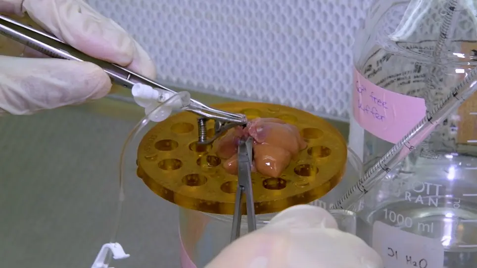 Isolation of Primary Rat Hepatocytes with Multiparameter Perfusion Control