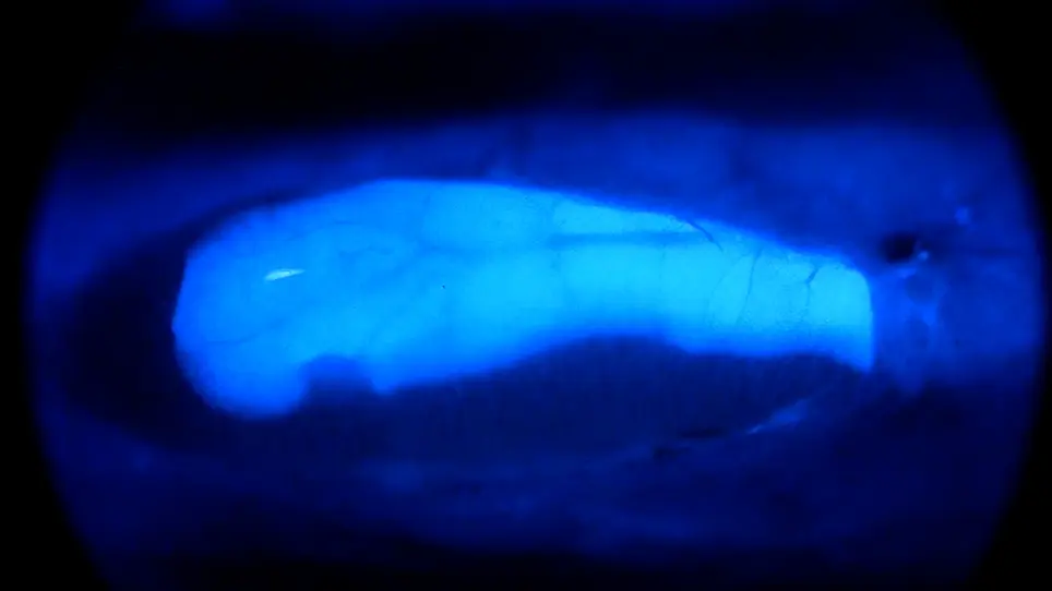 Partial Hepatectomy in Adult Zebrafish