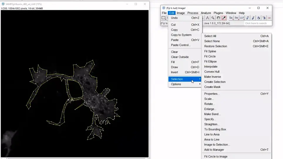 Automated Detection and Analysis of Exocytosis