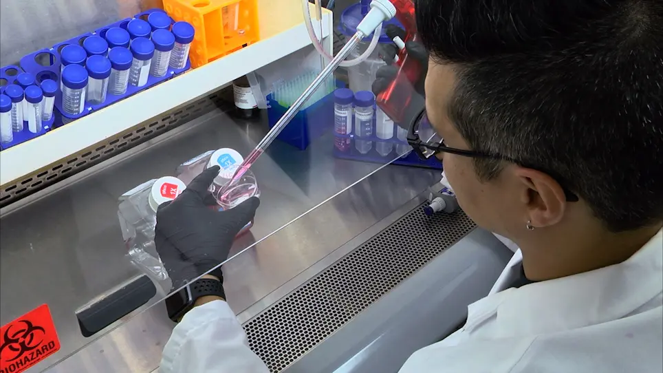 Isolation of Human Primary Valve Cells for In vitro Disease Modeling