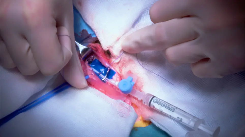 Creation of Two Saccular Elastase-Digested Aneurysms with Different Hemodynamics in One Rabbit