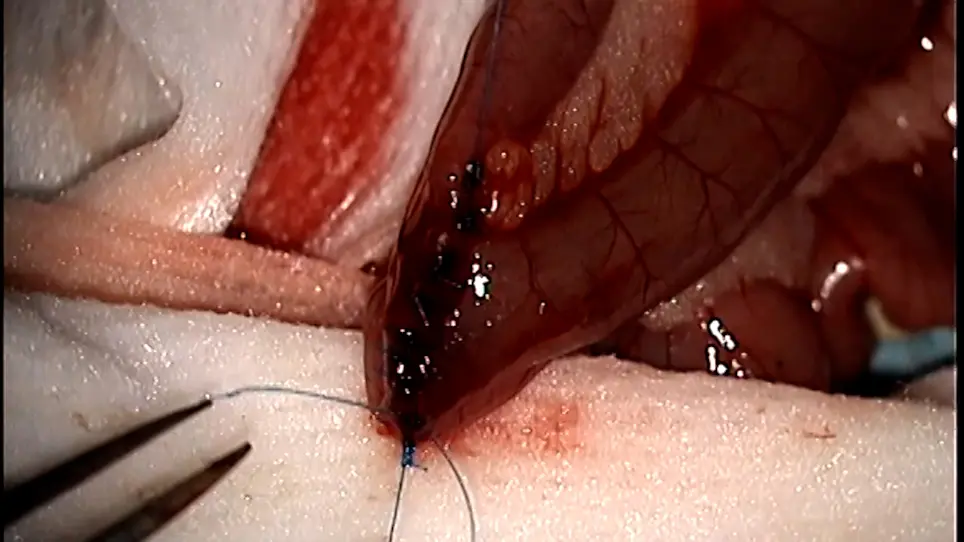A Protocol for Roux-en-Y Gastric Bypass in Rats using Linear Staplers