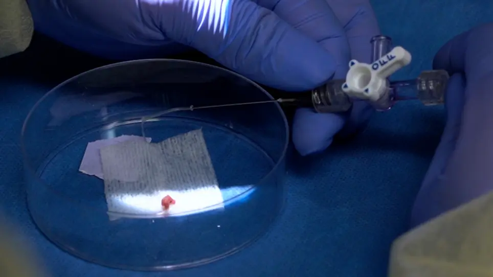 Surgery and Sample Processing for Correlative Imaging of the Murine Pulmonary Valve