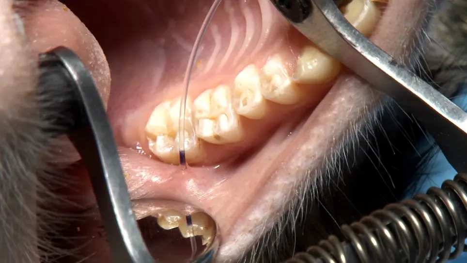 Retrograde Parotid Gland Infusion through Stensen's Duct in a Non-Human Primate for Vectored Gene Delivery