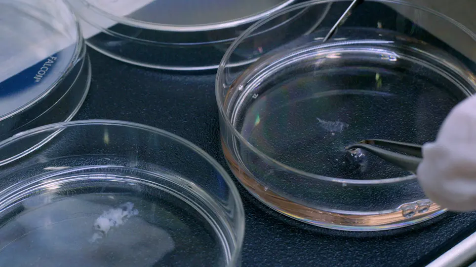 Isolation and Culture of Primary Oral Keratinocytes from the Adult Mouse Palate