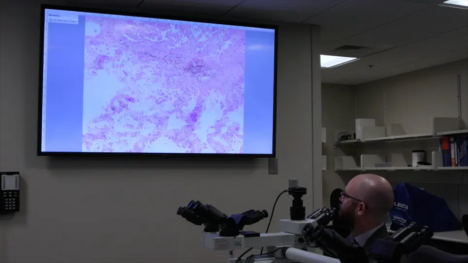 Enhancing Tumor Content through Tumor Macrodissection