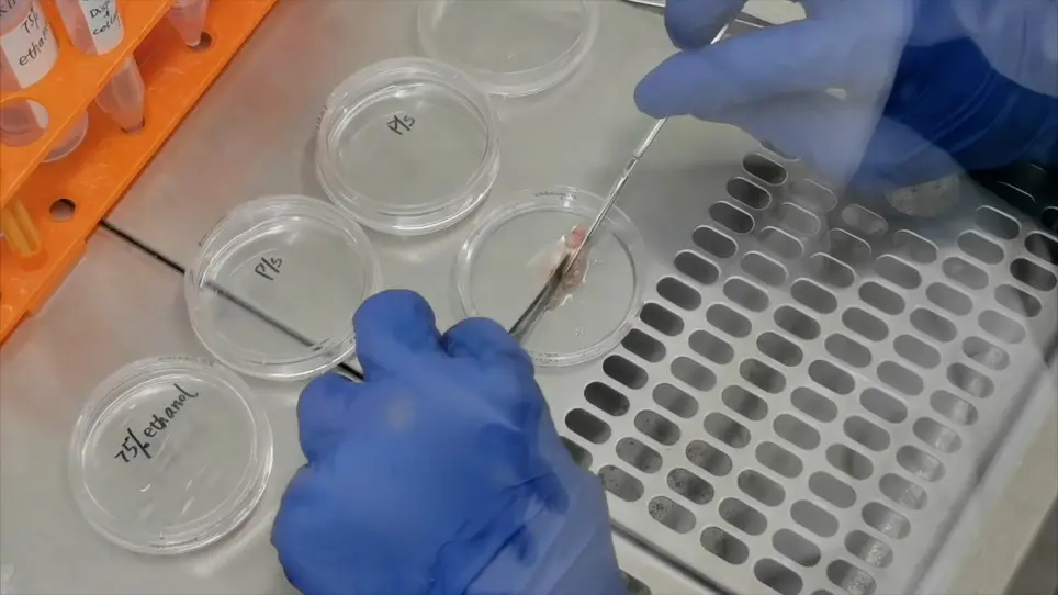Isolation and Culture of Primary Human Gingival Epithelial Cells using Y-27632